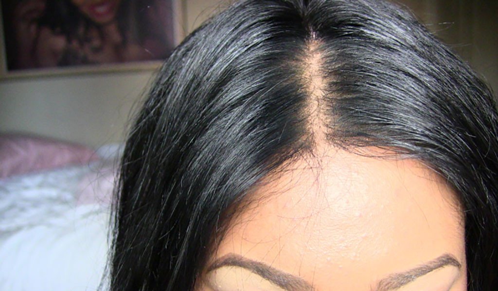 How to bleach your knots to perfection!